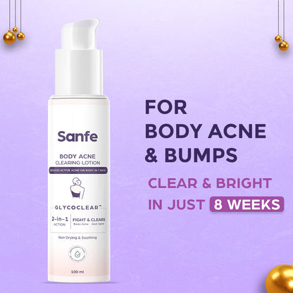 Sanfe Body Acne Clearing Lotion 100ml